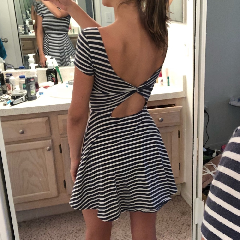 Abercrombie & Fitch Striped Skater Dress Open Back